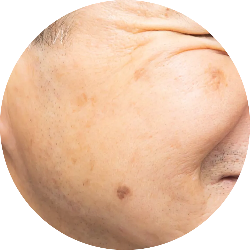 肌のたるみ、シミのイメージ