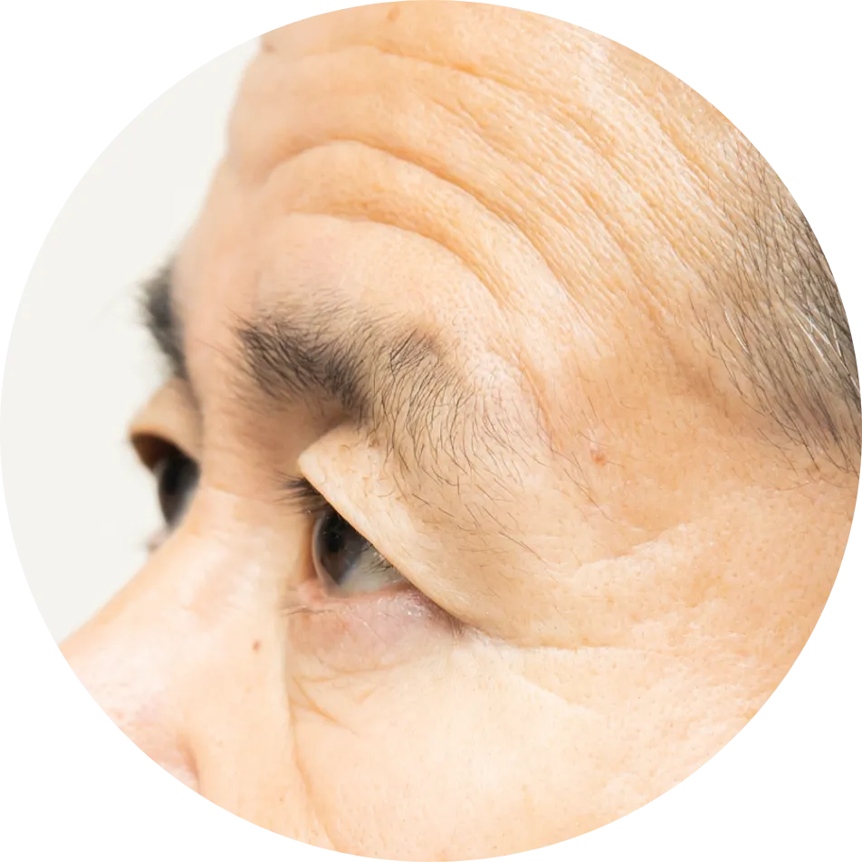 肌のたるみ、シワのイメージ